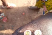 La crise post-électorale en Guinée compte ses morts