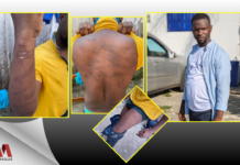 Gabon, Hans Otounga Obame enlevé et torturé